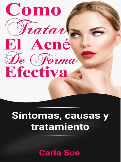 Title details for Como Tratar El Acné De Forma Efectiva by Carla Sue - Available